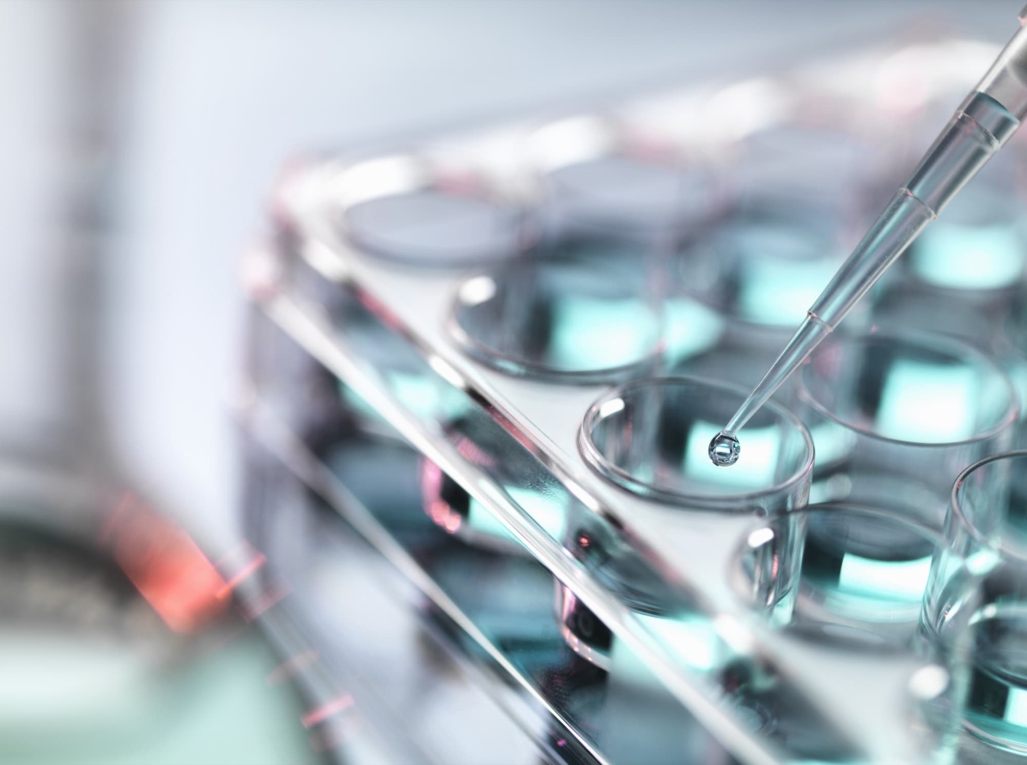 Getty Images 482185539 Pipetting sample tray